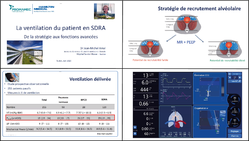 Webinar « Ventilation of patients with ARDS »